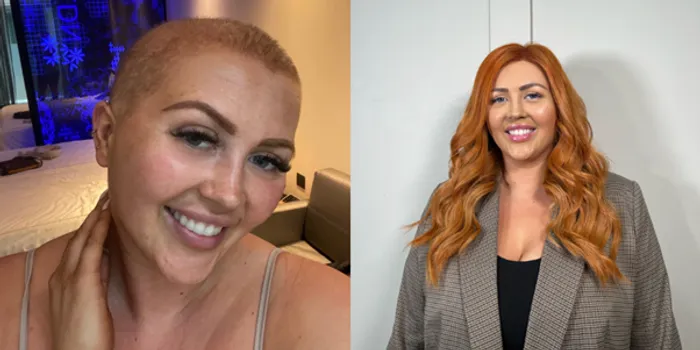 Split screen image of female wearing wig on right hand picture and shaved head on the left hand picture